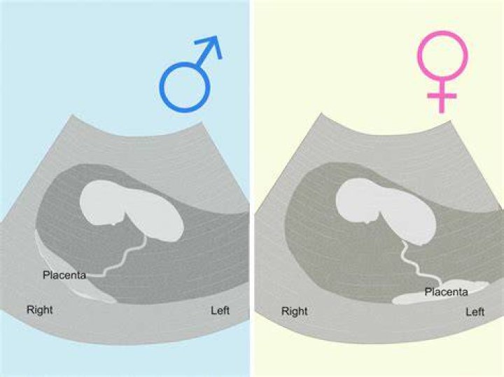 Can you tell by your bump if its a boy or girl?
