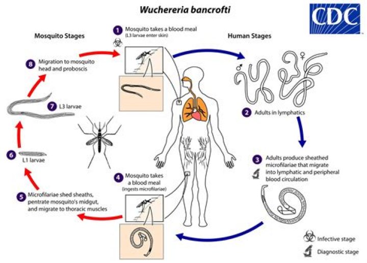 How do you get wuchereria Bancrofti?