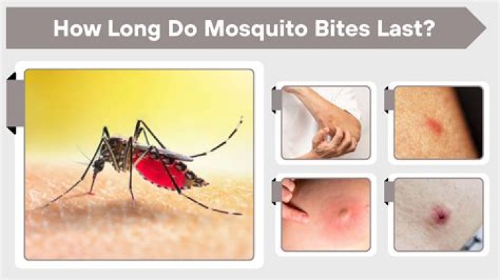 How long do mosquito bites last on skin?